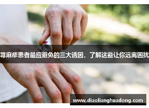 荨麻疹患者最应避免的三大诱因，了解这些让你远离困扰